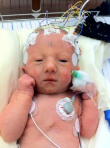 BK at Dell right after she was extubated with EEG still on